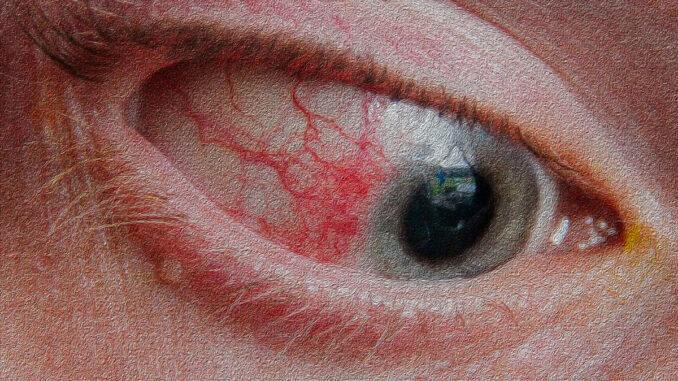 olhos_repcap