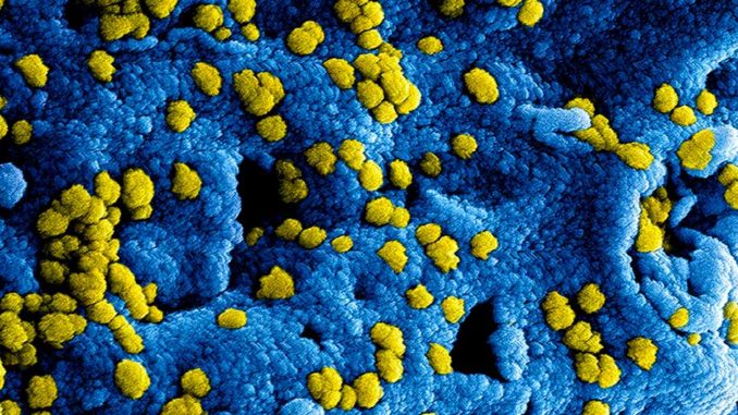 coronavirus_02