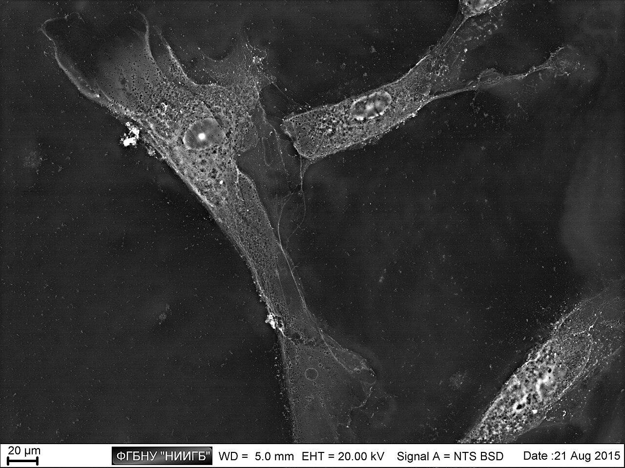 Células-tronco cerebrais: células do sangue antigas se tornam mais jovens com o tempo