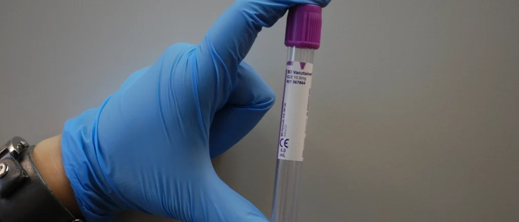 Diagnóstico do Alzheimer ganha exame de sangue aprovado pela Anvisa