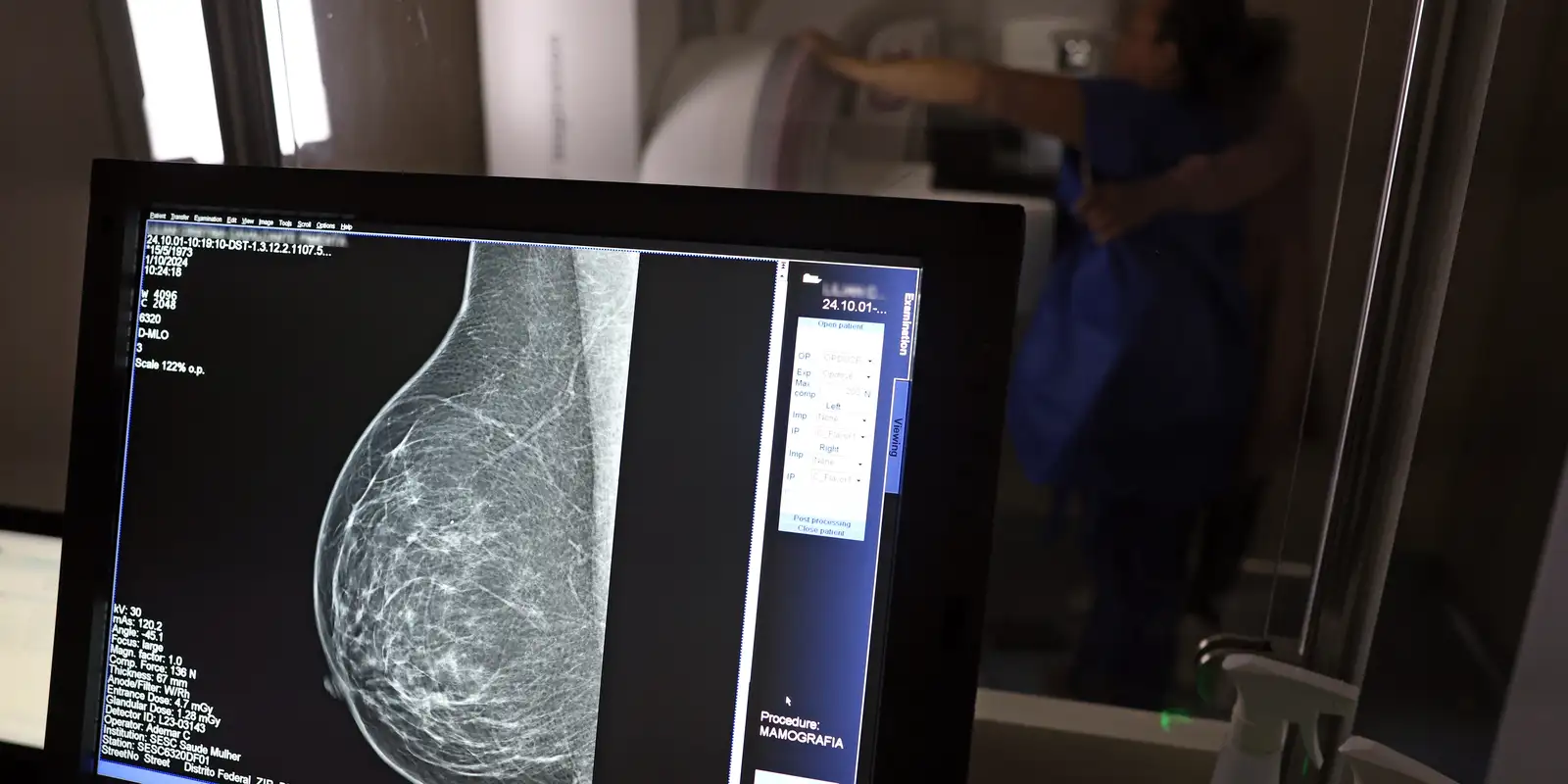 Mamografia digital: médicos divulgam guia para evitar recusa de pedidos pelos planos de saúde