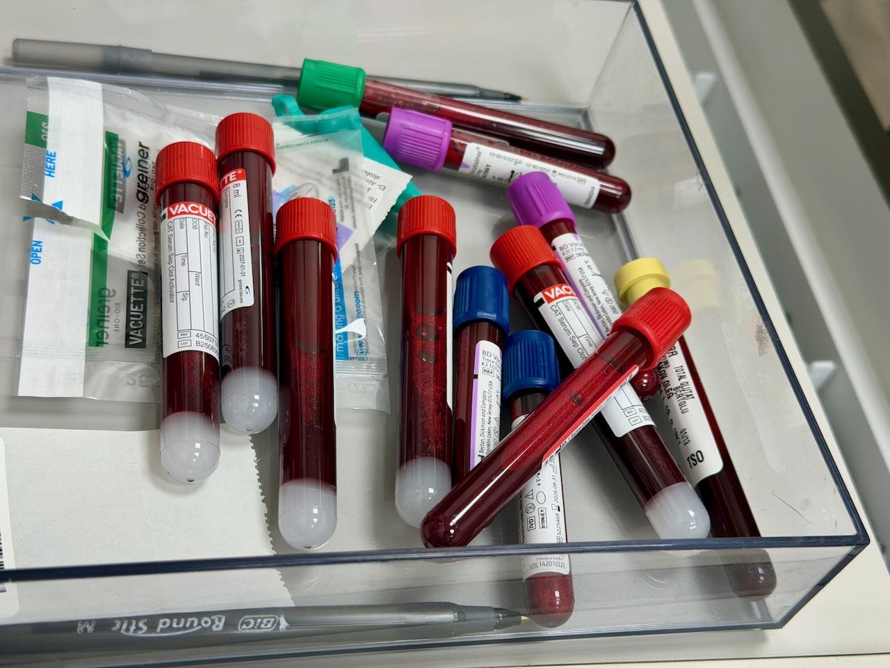 Sinais de ferritina baixa no rosto existem? Especialistas dizem que a aparência não basta